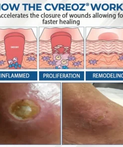 CVREOZ® Diabetes Foot Guard Fast Recovery Spray