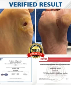 CVREOZ® Diabetes Foot Guard Fast Recovery Spray
