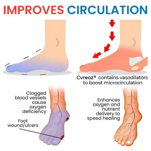 CVREOZ® Diabetic's Foot Cream