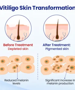 CVREOZ® Evenora Herbal Spray PRO
