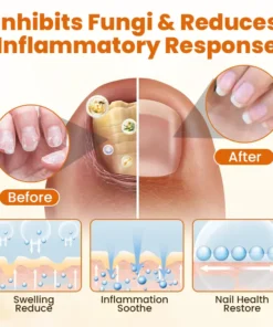 CVREOZ® FungiFix Bee Venom Nail Spray