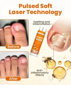 CVREOZ® FungiFix Bee Venom Nail Spray