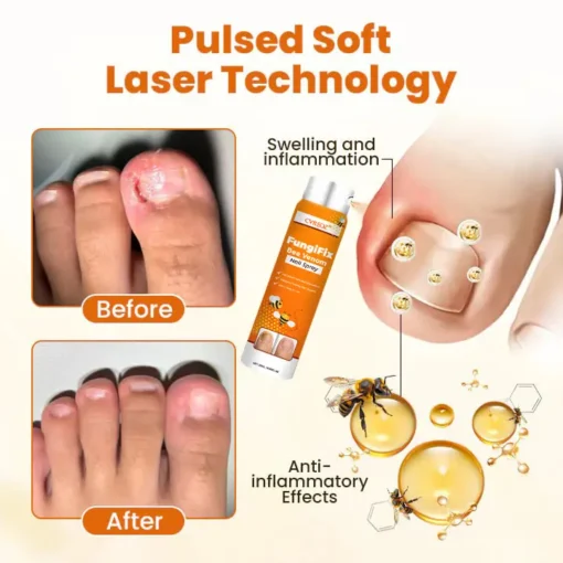 CVREOZ® FungiFix Bee Venom Nail Spray