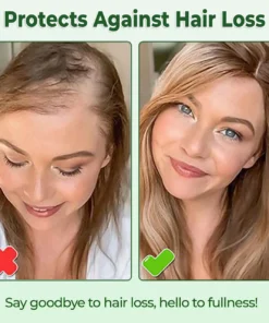 CVREOZ® Hair Growth Spray