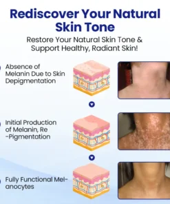 CVREOZ® Vitiligo Herbal Spray