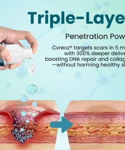 Cvreoz® Advanced Scar Gel