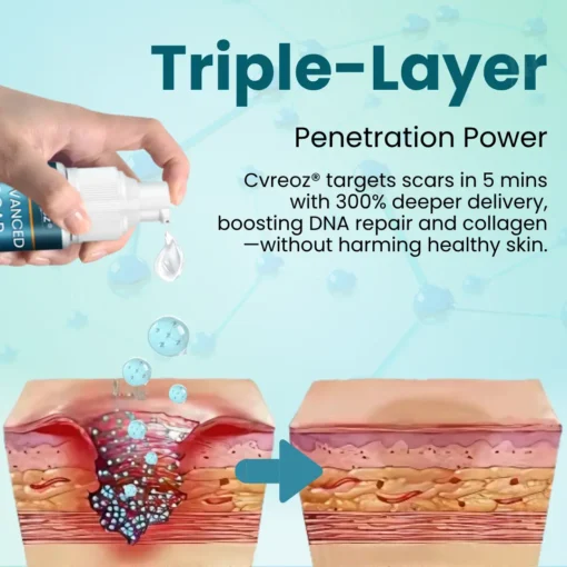 Cvreoz® Advanced Scar Gel