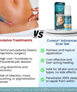 Cvreoz® Advanced Scar Gel