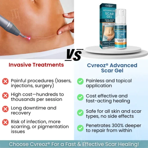 Cvreoz® Advanced Scar Gel