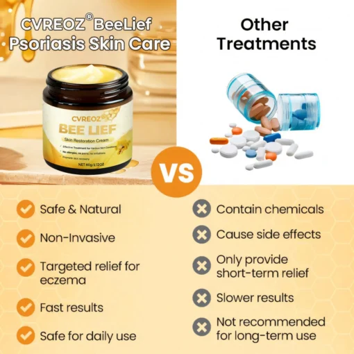 Cvreoz® BeeLief Psoriasis Skin Care Cream