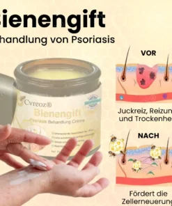 Cvreoz® Bienengift Psoriasis Behandlung Creme