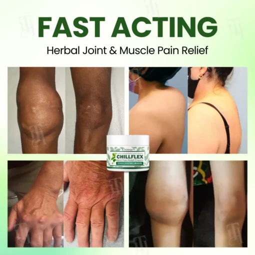 Cvreoz® Chillflex Mint Pain Relief Cream