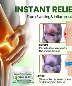 Cvreoz® Chillflex Mint Pain Relief Cream