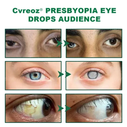 Cvreoz® Clear Life Eye Drops