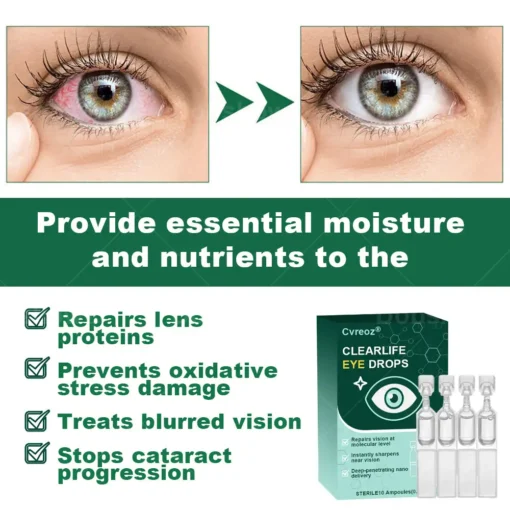 Cvreoz® Clear Life Eye Drops