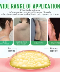 Cvreoz® DermaLump Relief Spray