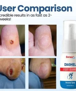 Cvreoz® DiaShield Foot Guard Recovery Spray