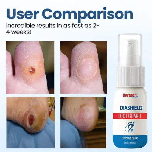 Cvreoz® DiaShield Foot Guard Recovery Spray