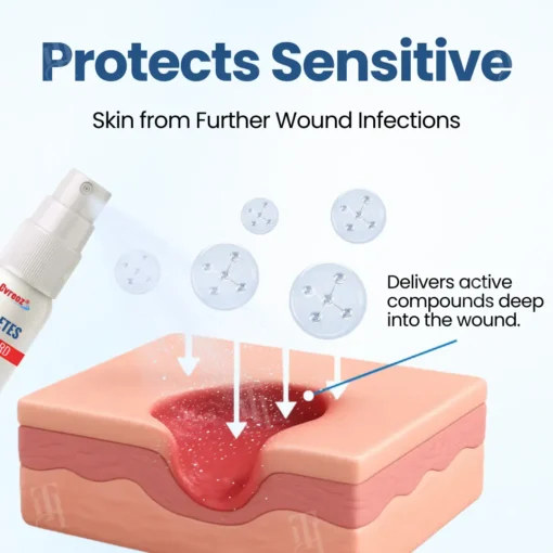Cvreoz® Diabetes Foot Guard Recovery Spray