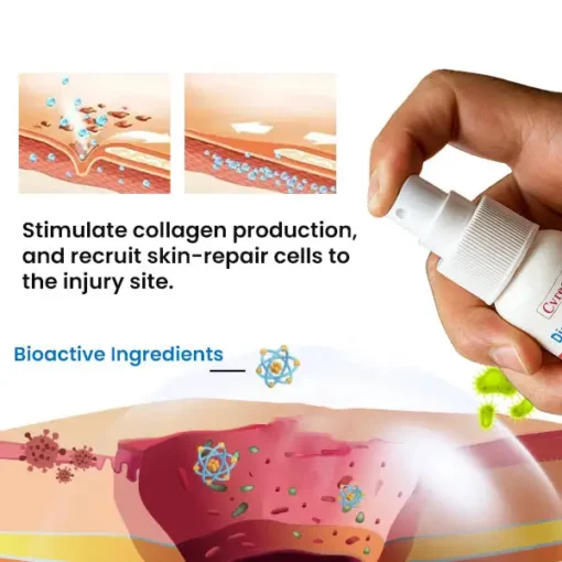 Cvreoz® Diabetic Foot Healing Spray