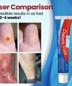 Cvreoz® Diabetic Foot Ulcer Repair Cream