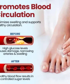 Cvreoz® Diabetic Foot Ulcer Repair Cream