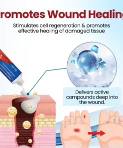 Cvreoz® Diabetic Foot Ulcer Repair Cream