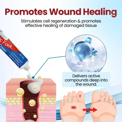 Cvreoz® Diabetic Foot Ulcer Repair Cream