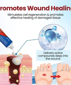 Cvreoz® Diabetic Foot Ulcer Repair Cream