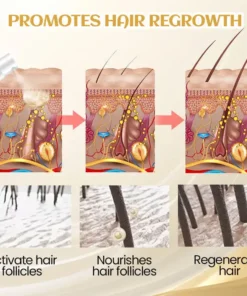 Cvreoz® Ginger Hair Regrowth Serum