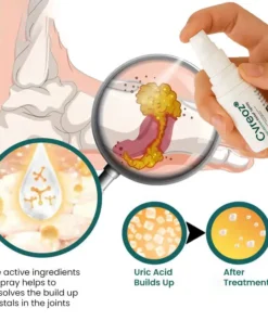 Cvreoz® GoutEase Relief Spray