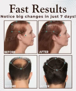 Cvreoz® Hair Regrowth Capsules
