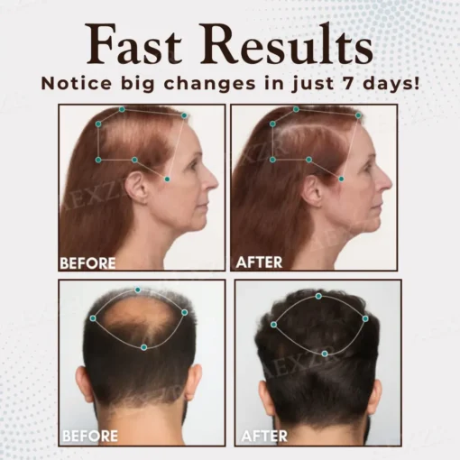 Cvreoz® Hair Regrowth Capsules