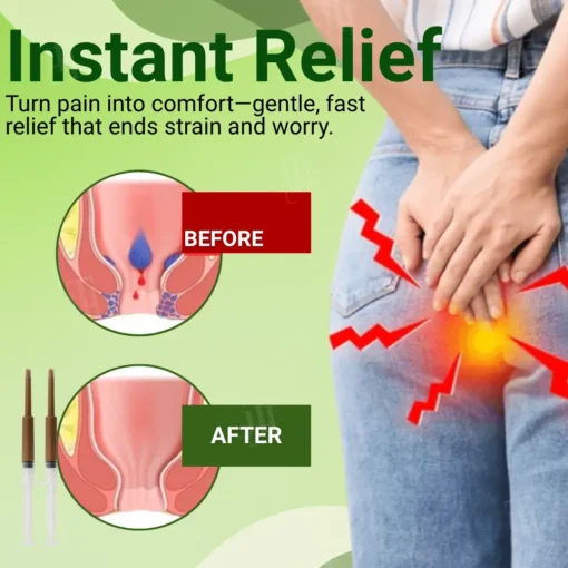 Cvreoz® Hemorrhoid Comfort Ointment