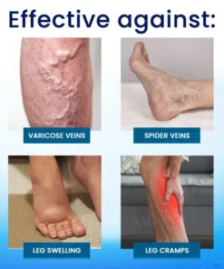 Cvreoz® Herbal Varicose Veins Treatment Spray