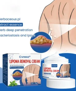 Cvreoz® Lipoma Removal Cream