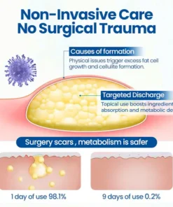 Cvreoz® Lipoma Removal Cream