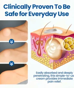 Cvreoz® Lipoma Removal Cream