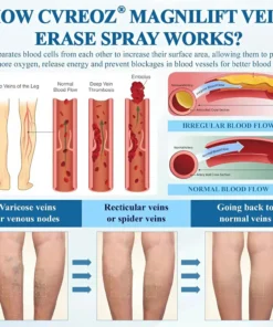 Cvreoz® MagniLift VeinErase Spray