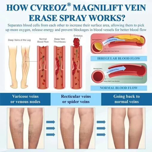 Cvreoz® MagniLift VeinErase Spray