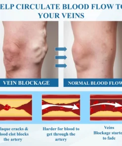 Cvreoz® MagniLift VeinErase Spray