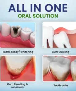 Cvreoz® Oral Solution Spray