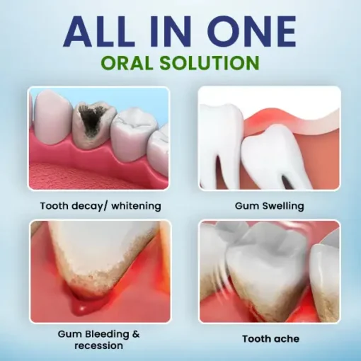 Cvreoz® Oral Solution Spray