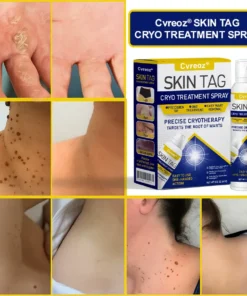 Cvreoz® Skin Tag Cryo Treatment Spray