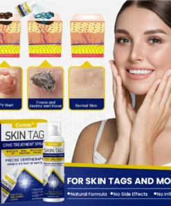Cvreoz® Skin Tag Cryo Treatment Spray