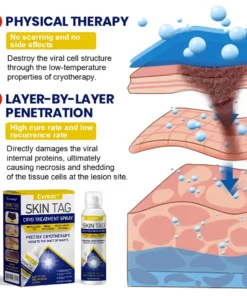 Cvreoz® Skin Tag Cryo Treatment Spray