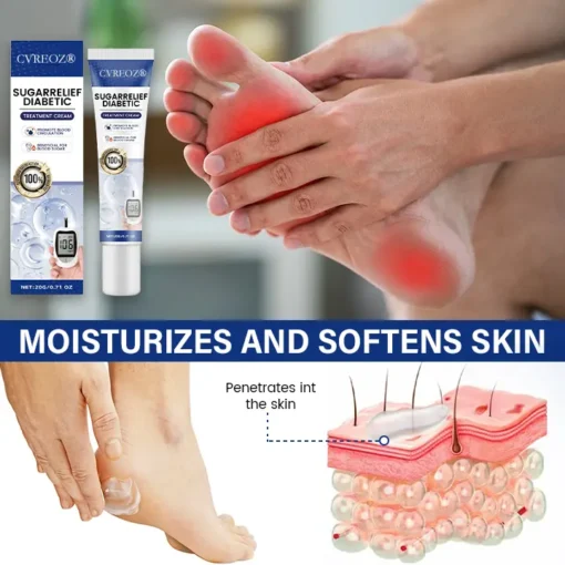 Cvreoz® SugarRelief Diabetic Treatment Cream