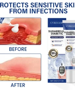 Cvreoz® SugarRelief Diabetic Treatment Cream