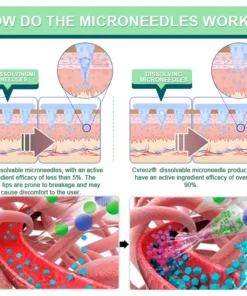 Cvreoz® Tirzepatide Slimming & health NANO MICRONEEDLE PATCH