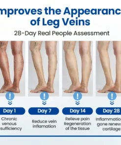 Cvreoz® Varicose Veins Patch